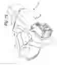 Fig. 75 - Patient positioning support apparatus with virtual pivot-shift pelvic pads, upper body stabilization and fail-safe table attachment mechanism
