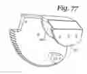 Fig. 77 - Patient positioning support apparatus with virtual pivot-shift pelvic pads, upper body stabilization and fail-safe table attachment mechanism