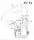 Fig. 84 - Patient positioning support apparatus with virtual pivot-shift pelvic pads, upper body stabilization and fail-safe table attachment mechanism