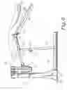 Fig. 07 - Modular multi-articulated patient support system