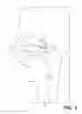 Fig. 03 - COMPOSITIONS AND METHODS FOR OTOLOGIC PROPHYLAXIS AND TREATMENT