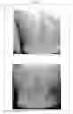 Fig. 04 - ANTIPERSPIRANT AGENT