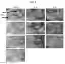 Fig. 06 - ANTIPERSPIRANT AGENT