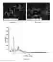 Fig. 08 - Sulphate salts of N-(3-(4-(3-(diisobutylamino)propyl)piperazin-1-yl)propyl)-1H-benzo[d]imidazol-2-amine, preparation thereof and use of the same