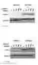 Fig. 33 - Method of treating non-small cell lung cancer and/or small cell lung cancer using thienotriazolodiazepine compounds
