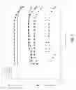 Fig. 04 - COMPOSITIONS AND METHODS FOR PREPARING AN INJECTABLE MEDIUM  FOR ADMINISTRATION INTO THE CENTRAL NERVOUS SYSTEM