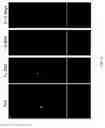 Fig. 09 - COMPOSITIONS AND METHODS FOR PREPARING AN INJECTABLE MEDIUM  FOR ADMINISTRATION INTO THE CENTRAL NERVOUS SYSTEM
