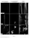 Fig. 32 - COMPOSITIONS AND METHODS FOR PREPARING AN INJECTABLE MEDIUM  FOR ADMINISTRATION INTO THE CENTRAL NERVOUS SYSTEM