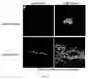 Fig. 34 - COMPOSITIONS AND METHODS FOR PREPARING AN INJECTABLE MEDIUM  FOR ADMINISTRATION INTO THE CENTRAL NERVOUS SYSTEM