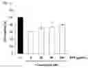 Fig. 02 - Method for protecting kidney function