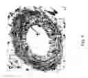Fig. 04 - Method of treating dyspnea associated with acute heart failure