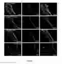 Fig. 08 - Induction of immunotolerance to improve acceptance of tissue derived from pluripotent stem cells