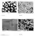 Fig. 02 - AUTO-POLYMERIZABLE PROSTHETIC MATERIAL AND POLYMERIZED, FRACTURE-TOUGH PROSTHETIC MATERIAL WITH INCREASED COLOUR STABILITY
