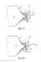 Fig. 10 - Highly efficient breastpump and system for expressing breastmilk