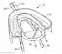 Fig. 01 - Methods and systems for improving airway patency