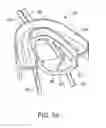 Fig. 05 - Methods and systems for improving airway patency