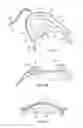 Fig. 10 - Methods and systems for improving airway patency