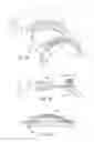 Fig. 13 - Methods and systems for improving airway patency