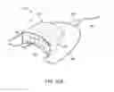 Fig. 18 - Methods and systems for improving airway patency