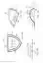 Fig. 29 - Methods and systems for improving airway patency