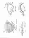 Fig. 31 - Methods and systems for improving airway patency