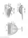 Fig. 33 - Methods and systems for improving airway patency