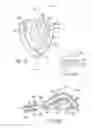 Fig. 35 - Methods and systems for improving airway patency