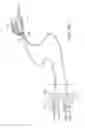 Fig. 37 - Methods and systems for improving airway patency