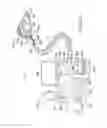 Fig. 40 - Methods and systems for improving airway patency