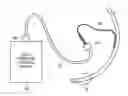 Fig. 01 - Cuff-pressure control device, cuffed tracheal tube, respirator, and obstruction detection method