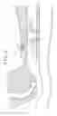 Fig. 02 - TRACHEAL TUBE