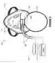 Fig. 03 - Oxygenation mask with integrated end-tidal carbon dioxide monitoring