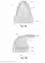 Fig. 03 - Seal forming structure for a patient interface and a tool and method of manufacturing the seal forming structure