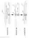 Fig. 07 - Patient interface and component parts