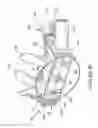 Fig. 12 - Patient interface and component parts