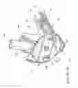 Fig. 14 - Patient interface and component parts