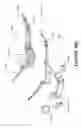 Fig. 34 - Patient interface and component parts