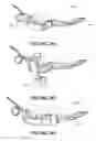 Fig. 35 - Patient interface and component parts