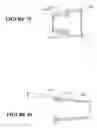 Fig. 71 - Patient interface and component parts