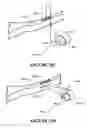 Fig. 84 - Patient interface and component parts