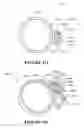 Fig. 87 - Patient interface and component parts