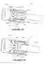 Fig. 98 - Patient interface and component parts