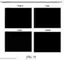 Fig. 22 - Methods and Systems for Delivery of a Trail of a Therapeutic Substance into an Anatomical Space