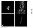 Fig. 72 - Methods and Systems for Delivery of a Trail of a Therapeutic Substance into an Anatomical Space