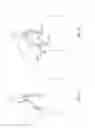 Fig. 06 - Methods and apparatus for inserting multi-lumen split-tip catheters into a blood vessel