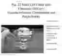 Fig. 22 - METHOD AND APPARATUS FOR MEASURING THE DOSE REMAINING UPON A TRANSDERMAL DRUG DELIVERY DEVICE