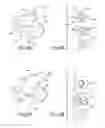 Fig. 06 - ANCHORING UNITS FOR IMPLANTABLE ELECTRICAL STIMULATION SYSTEMS AND METHODS OF MAKING AND USING