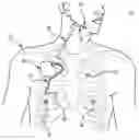 Fig. 01 - Percutaneous access for systems and methods of treating sleep-related disordered breathing