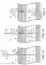 Fig. 08 - Percutaneous access for systems and methods of treating sleep-related disordered breathing
