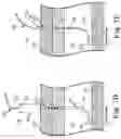 Fig. 09 - Percutaneous access for systems and methods of treating sleep-related disordered breathing